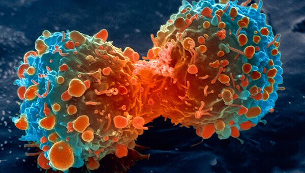 Mitos sobre o câncer