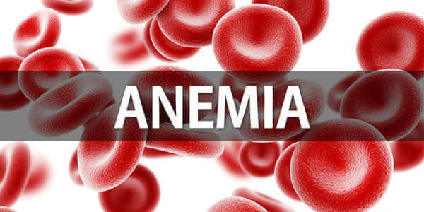 Anemia