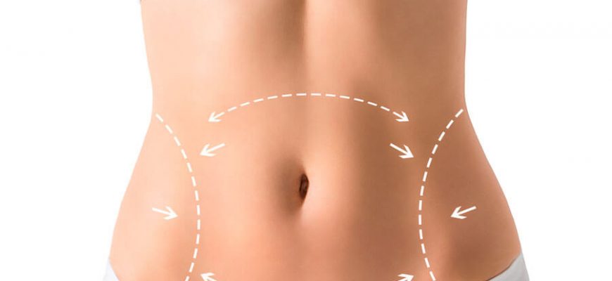 quanto custa uma abdominoplastia