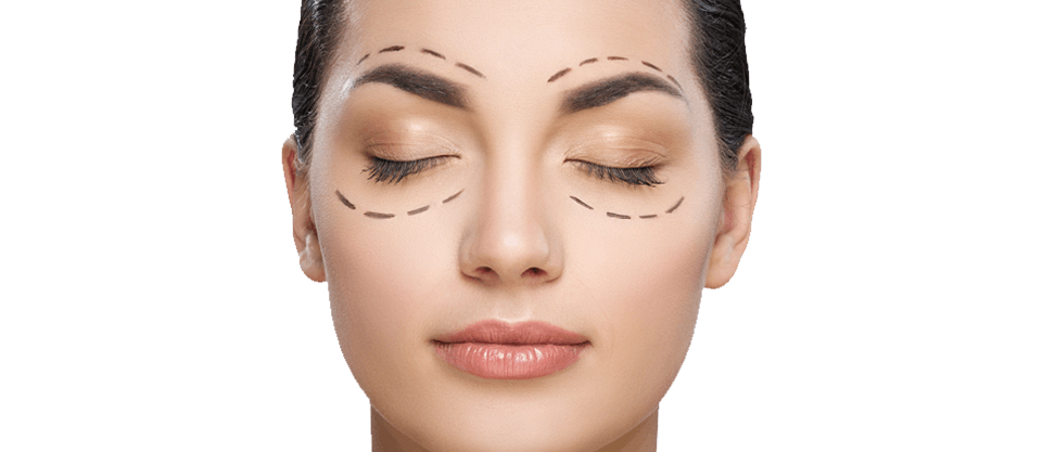 plano de saúde cobre blefaroplastia