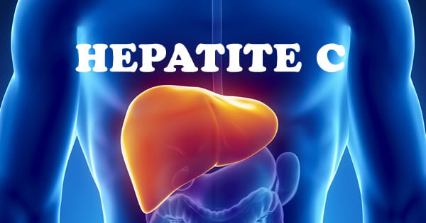 hepatite c