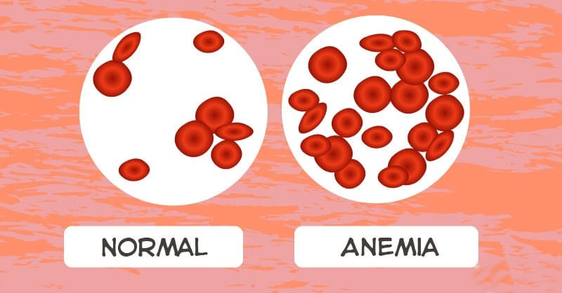 Sintomas da Anemia