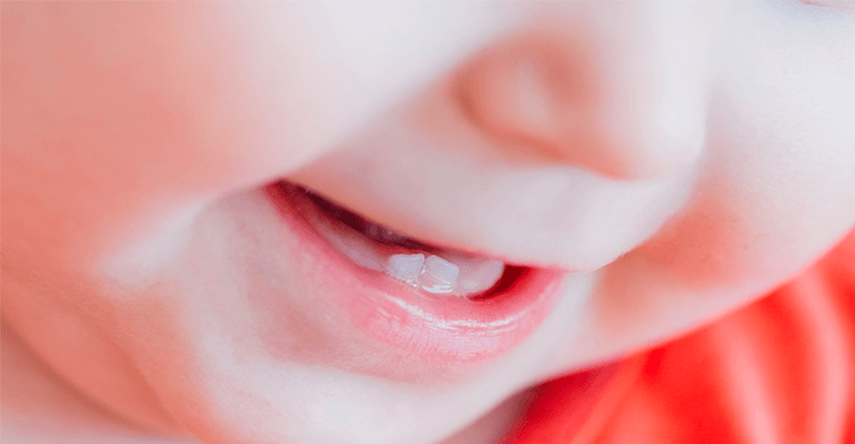 Bebê sorrindo com dentinhos embaixo