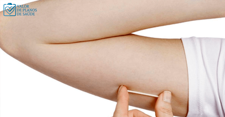 Mulher segurando implante anticoncepcional ao lado do braço